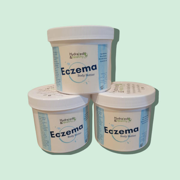 Eczema Body Butter