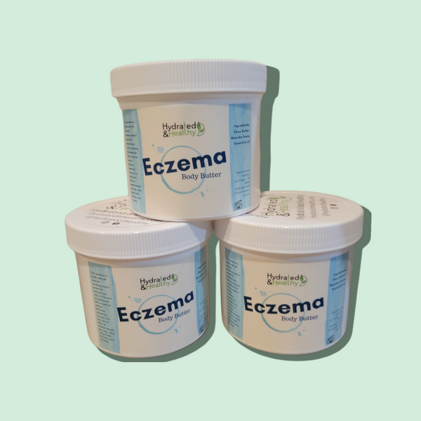 Trubaby 2024 eczema cream